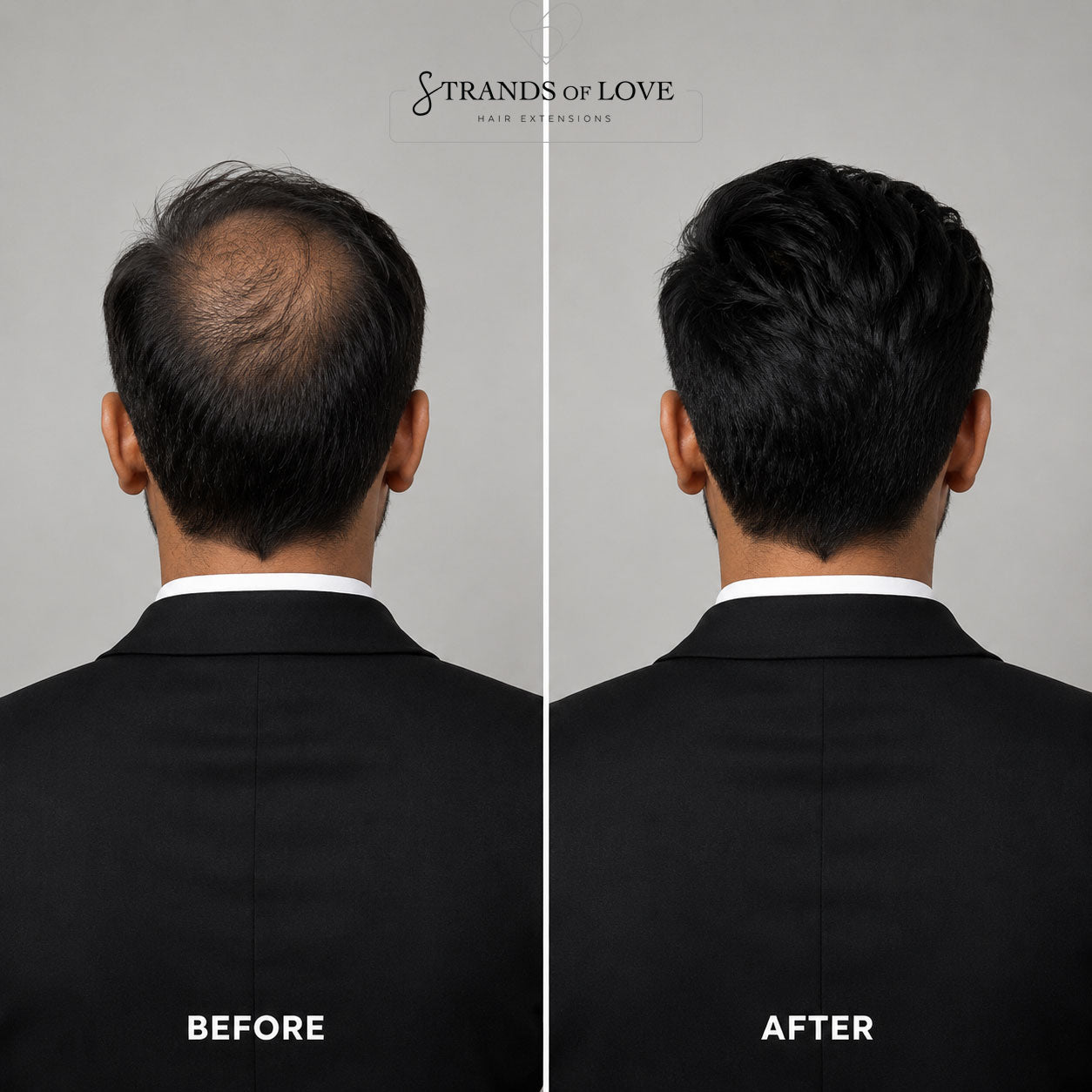 Men's Non-Surgical Hair System 001 - Black (#1) - Hybrid Base