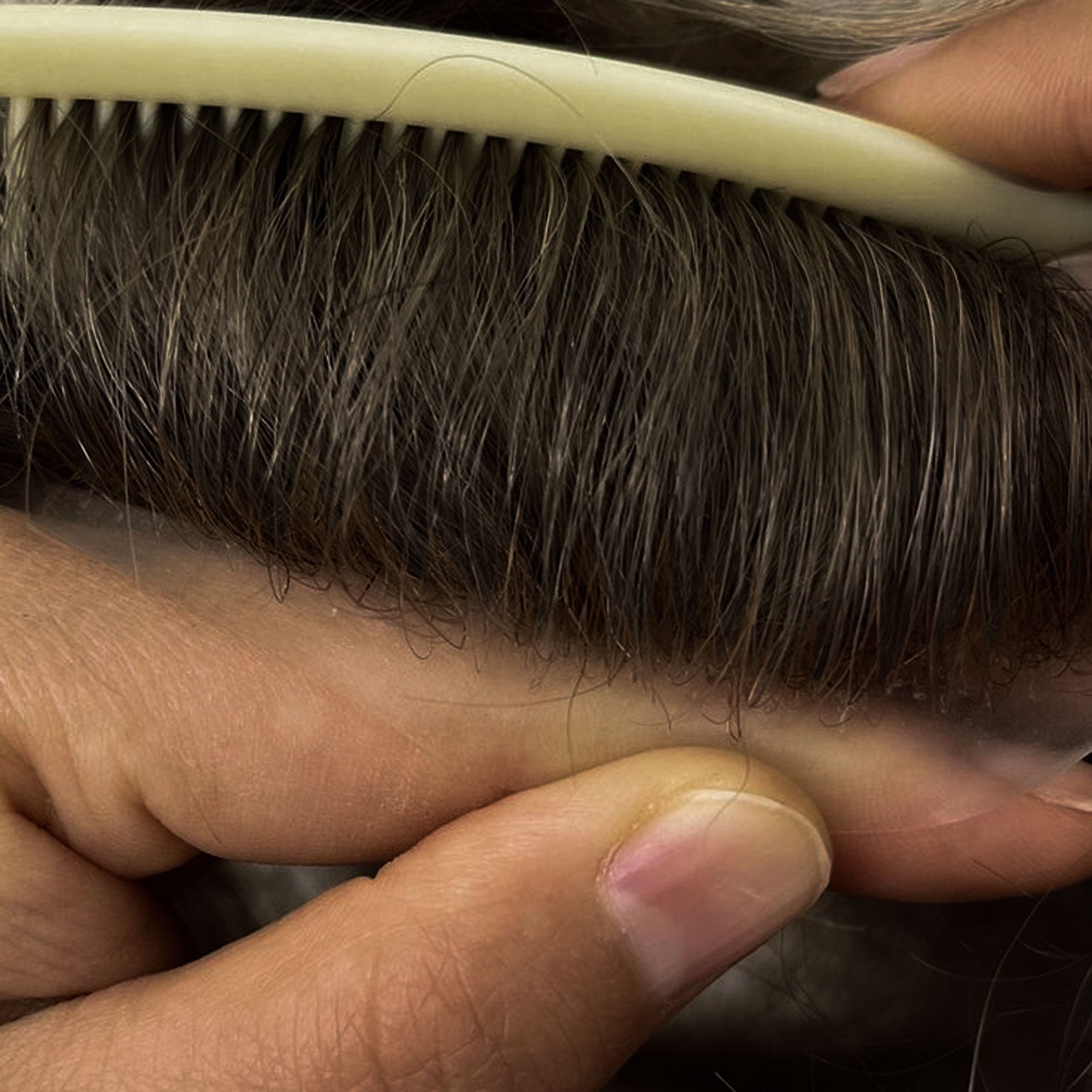 Men's Non-Surgical Hair System 009 - Ash Brown (#5) - Skin Base