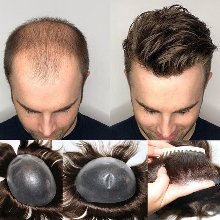 Men's Non-Surgical Hair System 005 - Natural Brown (#4 Ash) - Skin Base