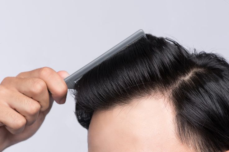 Men's Non-Surgical Hair System 014 - Black (#1) - Skin Base