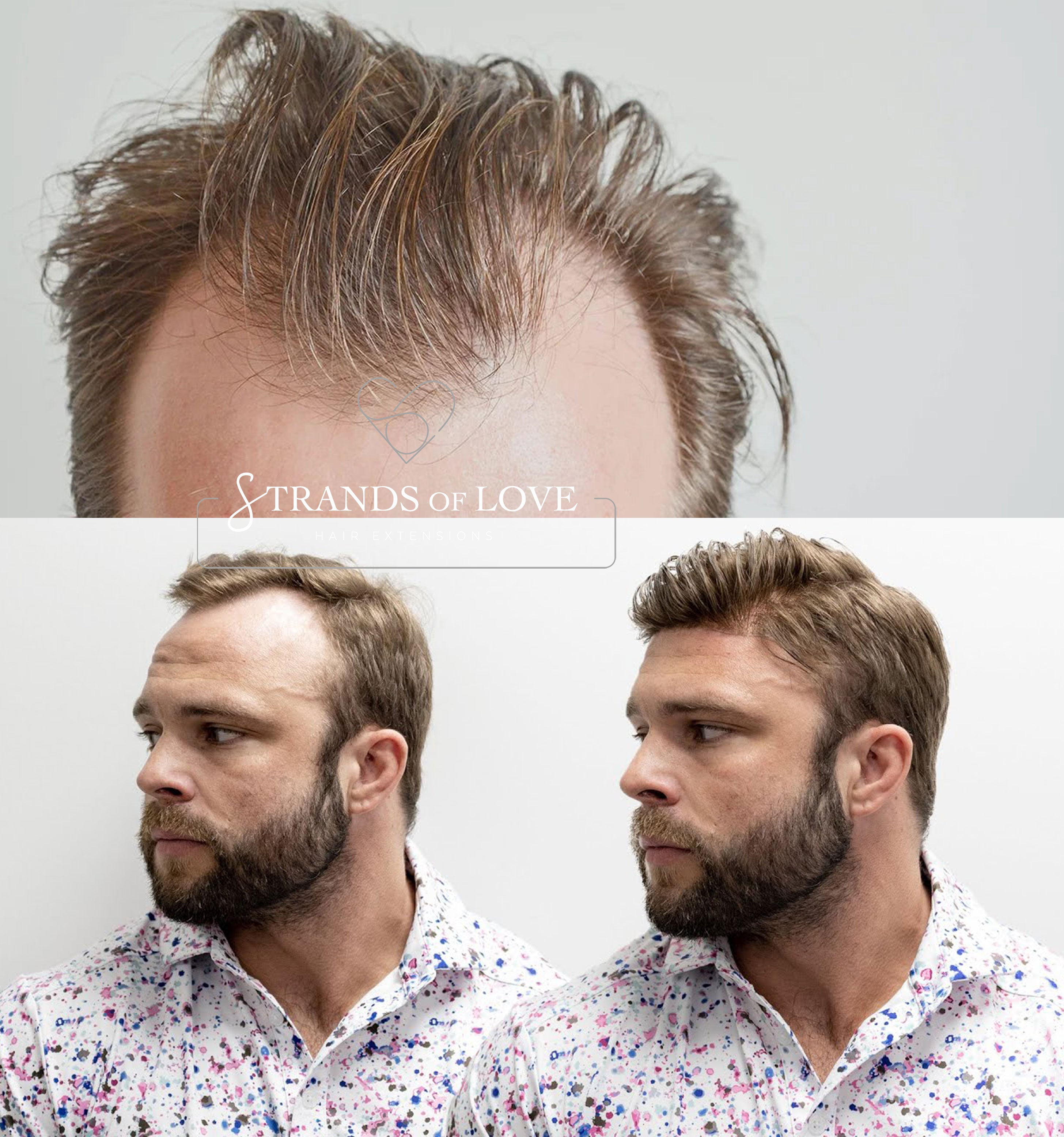 Men's Non-Surgical Hair FRONTAL 014 - Dark Blonde (#18) - Skin Base