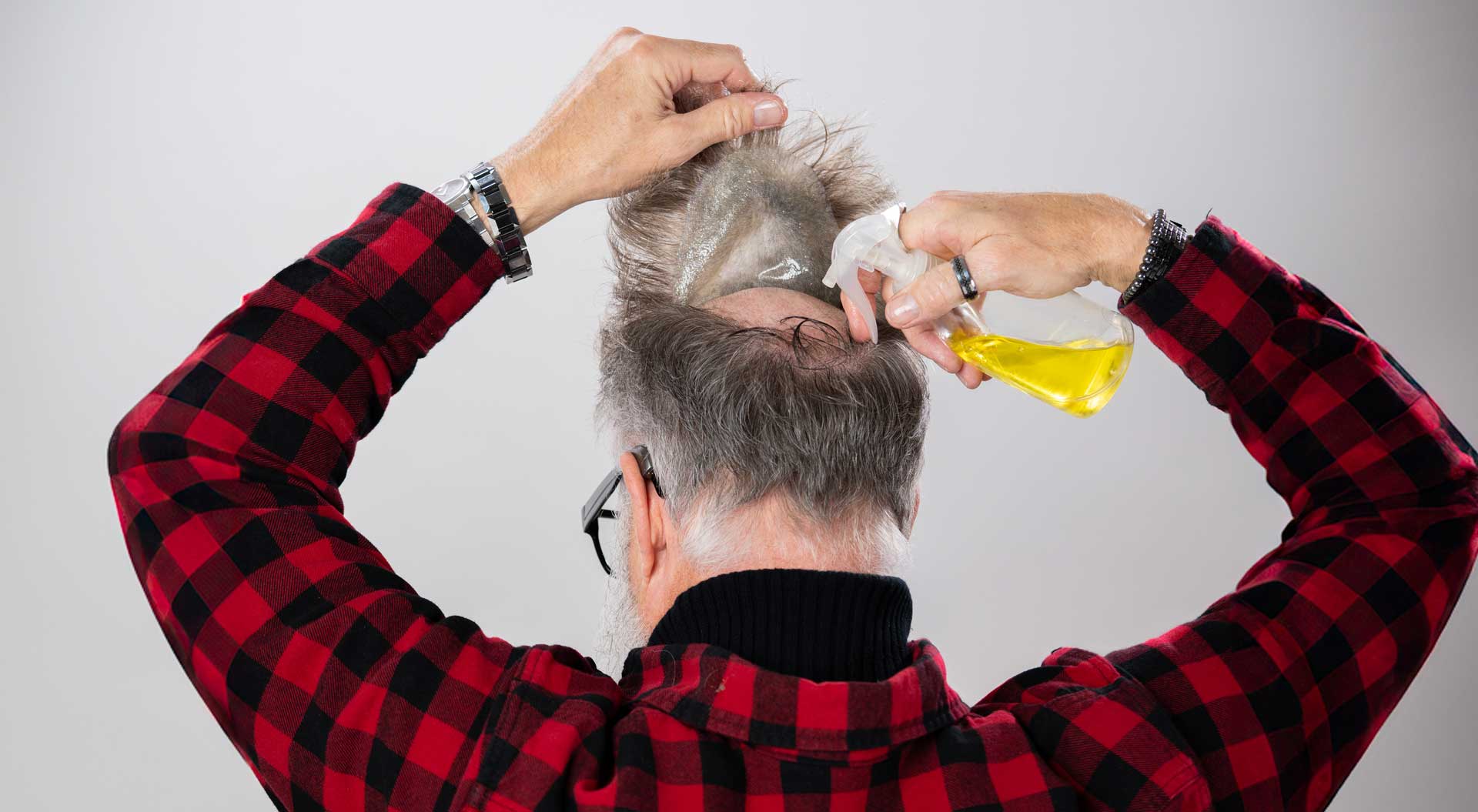 Men's Non-Surgical Hair System GLUE & TAPE REMOVER