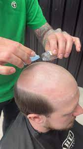 Men's Non-Surgical Hair System MAX HOLD SPORT SCALP PREP